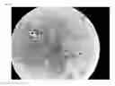 Fig. 11 - METHOD OF OBSERVING MICROORGANISM ACTIVITY IN A HUMAN TISSUE SAMPLE