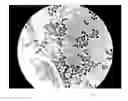 Fig. 14 - METHOD OF OBSERVING MICROORGANISM ACTIVITY IN A HUMAN TISSUE SAMPLE