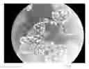 Fig. 17 - METHOD OF OBSERVING MICROORGANISM ACTIVITY IN A HUMAN TISSUE SAMPLE