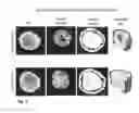 Fig. 04 - Motility-Contrast Imaging for Oocyte and Embryo Viability Assessment