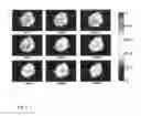 Fig. 07 - Motility-Contrast Imaging for Oocyte and Embryo Viability Assessment