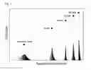 Fig. 02 - Methods for diagnosing and treating subjects for pulmonary exacerbation