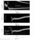 Fig. 06 - Method and system for direct slowness determination of dispersive waves in a wellbore environment