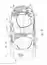 Fig. 05 - Lens movement assemblies for use with head mounted displays
