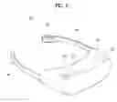 Fig. 03 - Head mount display device