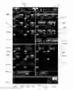 Fig. 01 - User interface system for a medical device