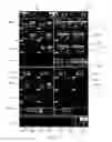 Fig. 05 - User interface system for a medical device
