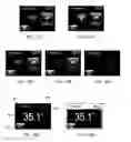 Fig. 13 - User interface system for a medical device