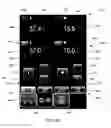 Fig. 20 - User interface system for a medical device