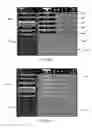 Fig. 33 - User interface system for a medical device
