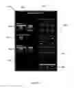 Fig. 45 - User interface system for a medical device
