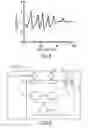 Fig. 04 - DEVICE, SYSTEM AND METHOD FOR DETECTING A HEALTH CONDITION OF A SUBJECT
