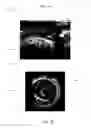 Fig. 10 - Systems and methods to reduce near-field artifacts