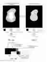 Fig. 03 - Digital image blemish removal