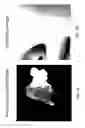 Fig. 07 - Digital image blemish removal
