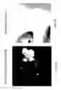 Fig. 08 - Digital image blemish removal