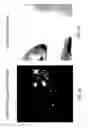 Fig. 09 - Digital image blemish removal