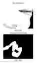 Fig. 16 - Digital image blemish removal