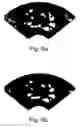 Fig. 06 - Medical image processing apparatus and method