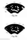 Fig. 07 - Medical image processing apparatus and method