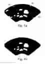 Fig. 08 - Medical image processing apparatus and method