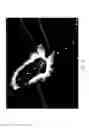 Fig. 03 - Intravascular imaging user interface systems and methods