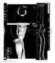 Fig. 07 - Intravascular imaging user interface systems and methods