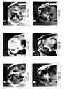 Fig. 04 - System and method for tissue characterization based on texture information using multi-parametric MRI