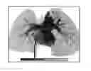 Fig. 01 - Medical image processing apparatus and medical image processing method