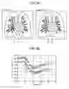Fig. 04 - Medical image processing apparatus and medical image processing method