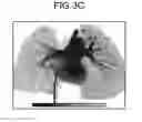 Fig. 05 - Medical image processing apparatus and medical image processing method