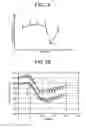 Fig. 09 - Medical image processing apparatus and medical image processing method