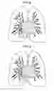 Fig. 10 - Medical image processing apparatus and medical image processing method