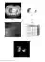 Fig. 01 - VOLUMETRIC TEXTURE SCORE