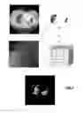 Fig. 07 - VOLUMETRIC TEXTURE SCORE