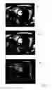 Fig. 09 - Intelligent medical image landmark detection