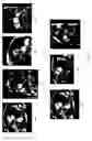 Fig. 10 - Intelligent medical image landmark detection