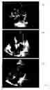 Fig. 11 - Intelligent medical image landmark detection