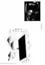 Fig. 12 - Intelligent medical image landmark detection