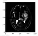Fig. 01 - DETERMINING IMAGE FEATURES FOR ANALYTICAL MODELS USING S-TRANSFORM