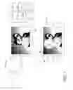 Fig. 02 - LOCALIZED BRUSH STROKE PREVIEW