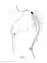 Fig. 02 - IMPROPER SPINAL CURVATURE WARNING APPARATUS
