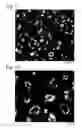 Fig. 06 - Method and apparatus for producing microporous metal foil