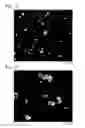 Fig. 07 - Method and apparatus for producing microporous metal foil
