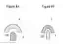 Fig. 05 - Nitride semiconductor device with asymmetric electrode tips