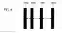 Fig. 06 - Back-contact solar cell and method for manufacturing the same