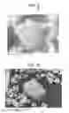 Fig. 08 - Negative electrode material, negative electrode for lithium ion secondary battery, lithium ion secondary battery, and method of manufacturing the same