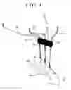 Fig. 04 - Fixture, fixing assembly, and fixation method for fixing power line to base member