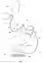 Fig. 05 - Corded-cordless headset solution