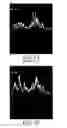 Fig. 03 - SYSTEM AND METHOD OF SYNCHRONIZING A VIDEO SIGNAL AND AN AUDIO STREAM IN A CELLULAR SMARTPHONE